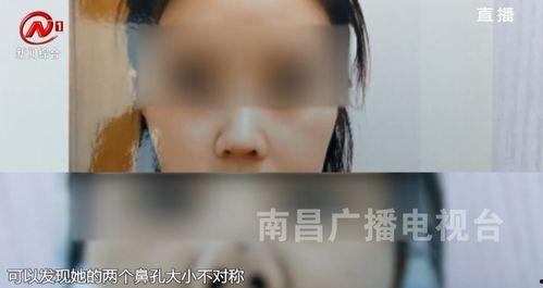 南昌医美爆料事件视频,行业乱象引发公众关注 第2张 南昌医美爆料事件视频,行业乱象引发公众关注 第2张